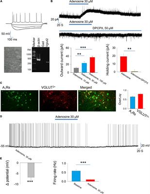 Adenosine Downregulates the Activities of Glutamatergic Neurons in the Paraventricular Hypothalamic Nucleus Required for Sleep